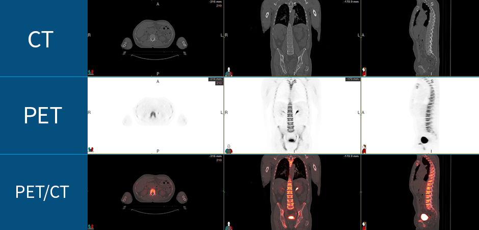 pet-ct-scans.jpg#asset:680