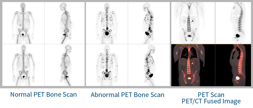 pet_bone_scan.jpg#asset:709