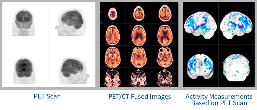 pet_brain_scan.jpg#asset:710